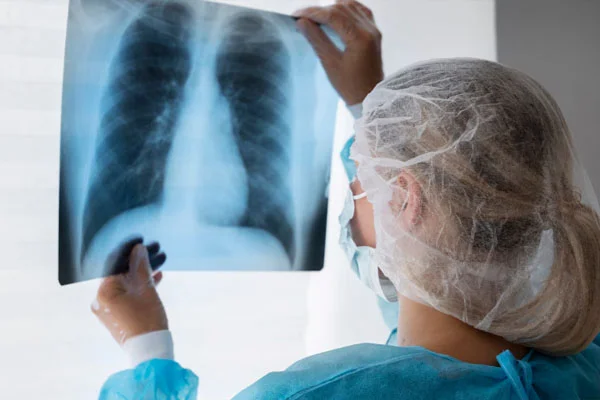 İliak Ven Skışması